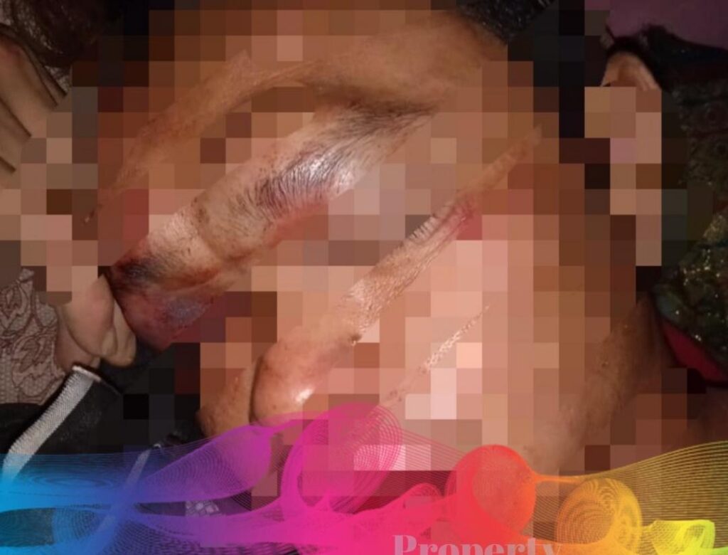 Pemuda Asal Desa Alasdowo Jadi Korban Pengkroyokan