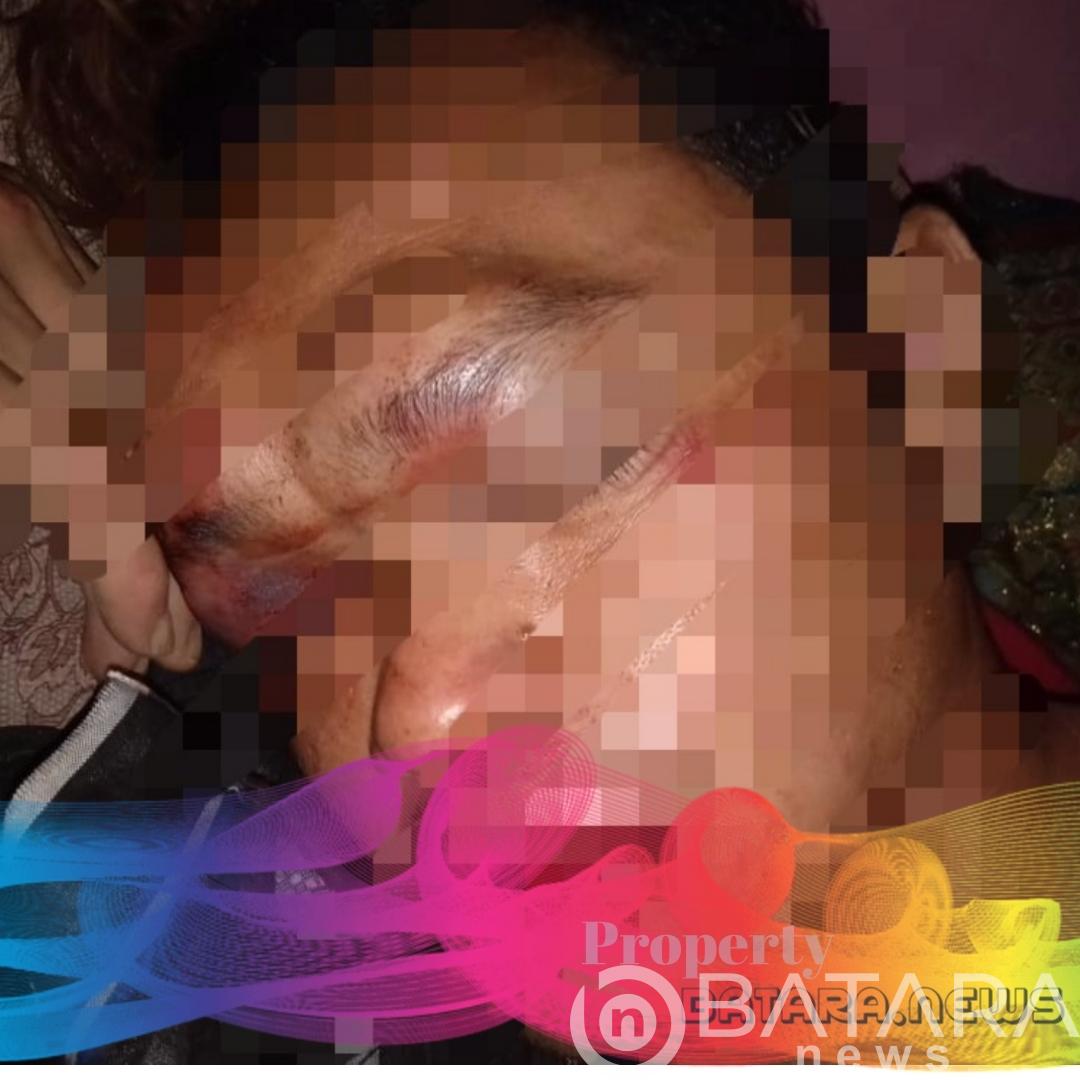 Pemuda Asal Desa Alasdowo Jadi Korban Pengkroyokan Pemuda Asal Desa Alasdowo Jadi Korban Pengkroyokan