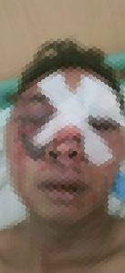 Pemuda Desa Wonokerto Kecamatan Sale Di Kroyok Babak Belur, Ayah Korban Laporkan Kejadian Ke Polres Rembang