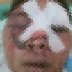 Pemuda Desa Wonokerto Kecamatan Sale Di Kroyok Babak Belur, Ayah Korban Laporkan Kejadian Ke Polres Rembang