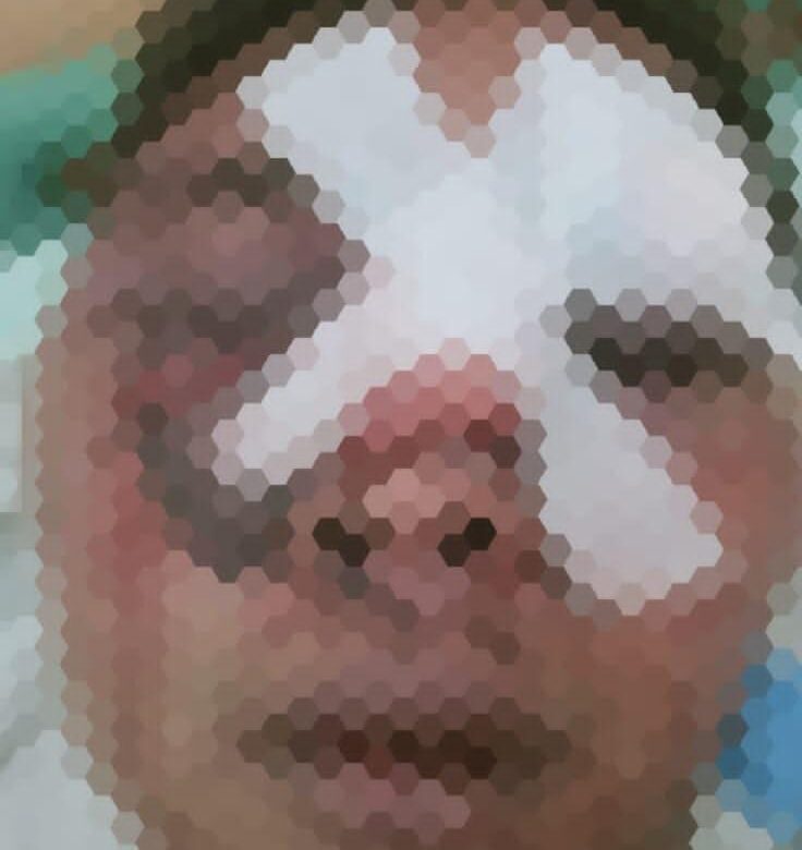 Pemuda Desa Wonokerto Kecamatan Sale Di Kroyok Babak Belur, Ayah Korban Laporkan Kejadian Ke Polres Rembang