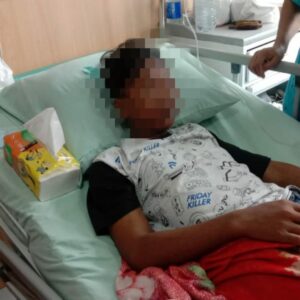 Miris” Hanya Karena Ambil Mangga, Seorang Anak Dibawah Umur Terkena Lemparan Batu Oleh Oknum Penjaga Sekolah
