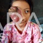 SITI AZMIRA DEA NOVA BUTUH PENANGAN RUMAH SAKIT. SEMOGA BAPAK GUBERNUR JAWABARAT BAPAK RIDWAN KAMIL DAN JAJARANNYA BISA MEMBERIKAN BANTUAN DAN RESPON CEPAT