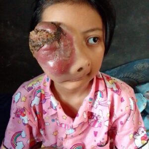 SITI AZMIRA DEA NOVA BUTUH PENANGAN RUMAH SAKIT. SEMOGA BAPAK GUBERNUR JAWABARAT BAPAK RIDWAN KAMIL DAN JAJARANNYA BISA MEMBERIKAN BANTUAN DAN RESPON CEPAT