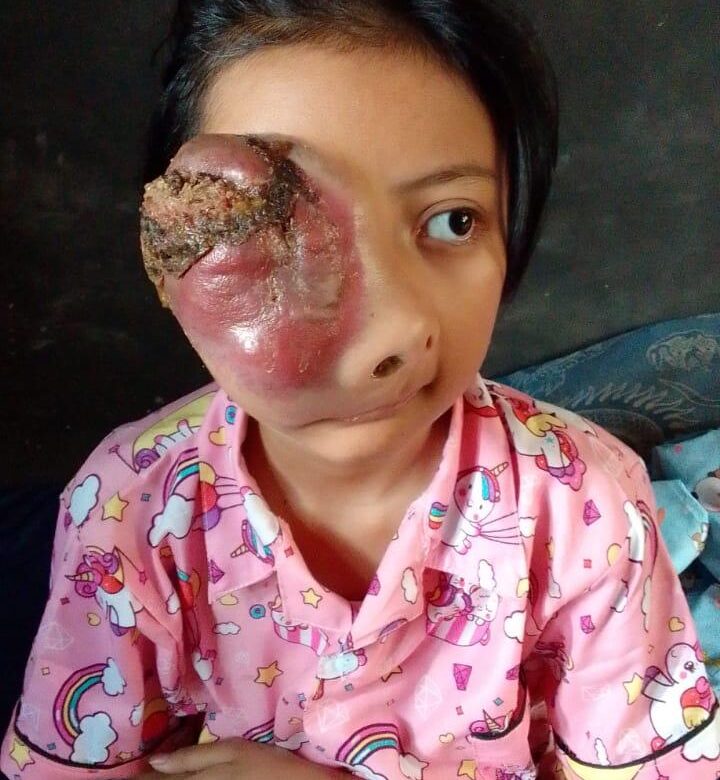 SITI AZMIRA DEA NOVA BUTUH PENANGAN RUMAH SAKIT. SEMOGA BAPAK GUBERNUR JAWABARAT BAPAK RIDWAN KAMIL DAN JAJARANNYA BISA MEMBERIKAN BANTUAN DAN RESPON CEPAT