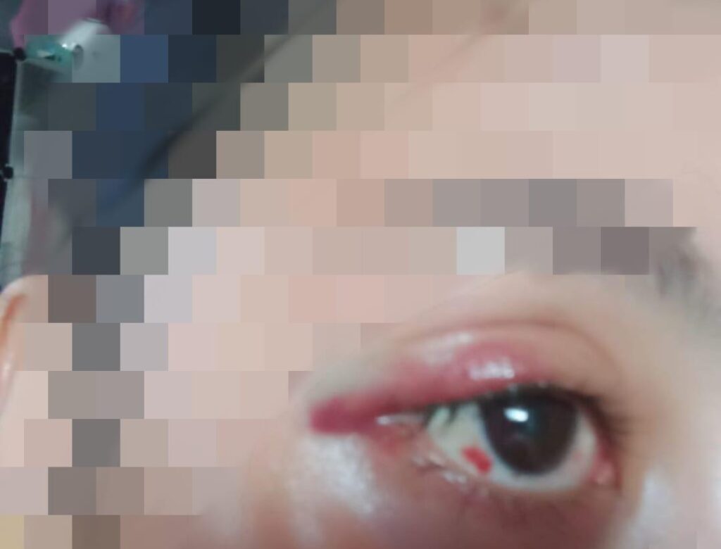 Kembali Terjadi! Akibat KDRT, Seorang Suami Dilaporkan Istrinya Ke Polisi