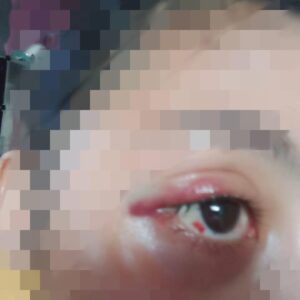 Kembali Terjadi! Akibat KDRT, Seorang Suami Dilaporkan Istrinya Ke Polisi