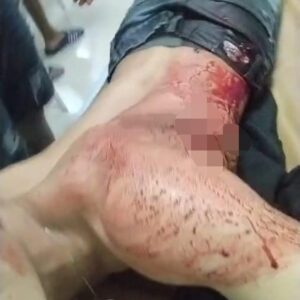 Hendak Melintas Pemuda Ini Jadi Korban Bacok, Bentrok Gangster Di Jalan Tayu Juwana