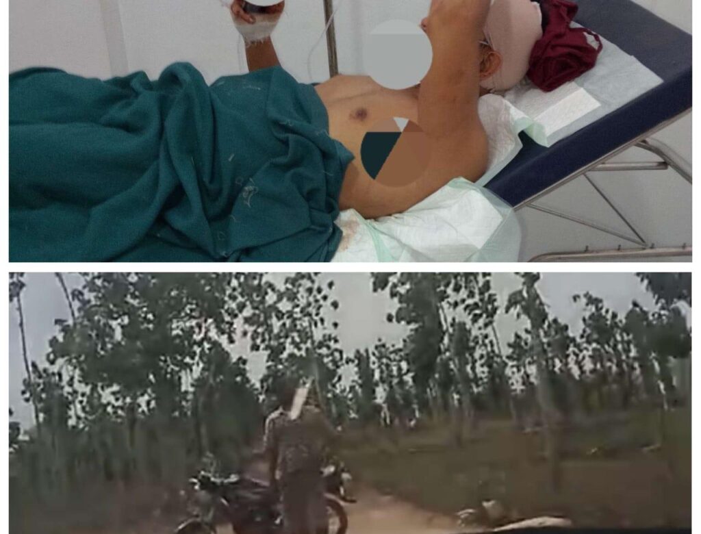 Obok-Obok Lokasi Tambang Rakyat Di Tuban, Oknum Wartawan Di Bacok Warga